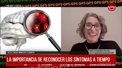 ACV:Cada minuto cuenta- La importancia de reconocer los s&iacute;ntomas a tiempo
